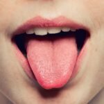 चिकित्सकले किन हेर्छन् बिरामीको जिब्रो ?
