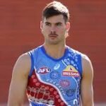 AFL खेलाडी जमारा उग्ले-हागन प्रहरी अनुसन्धानमा